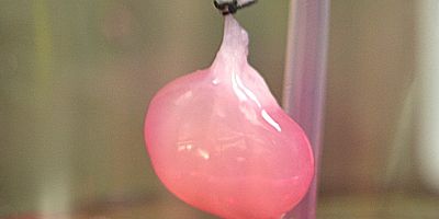 Bilim İnsanları Laboratuvarda İşlevsel Böbrek Geliştirdi